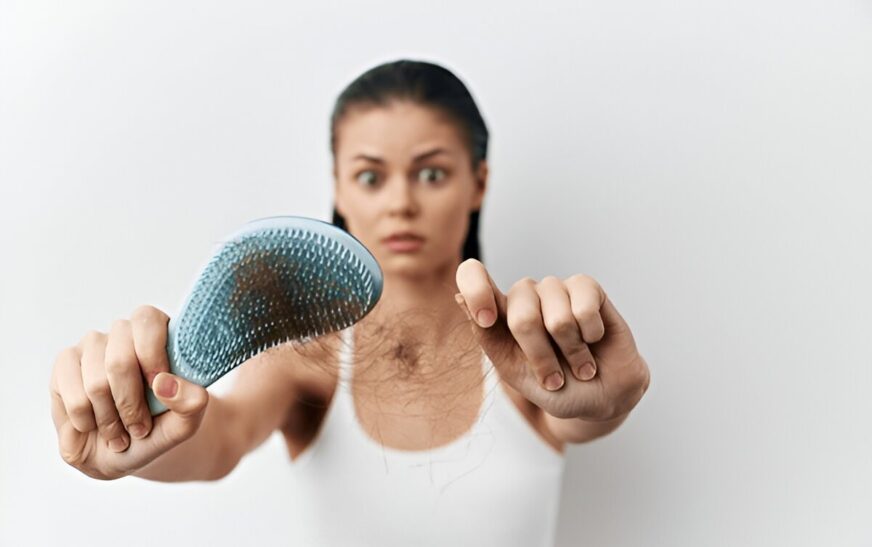 Tips for Preventing Hair Loss Naturally